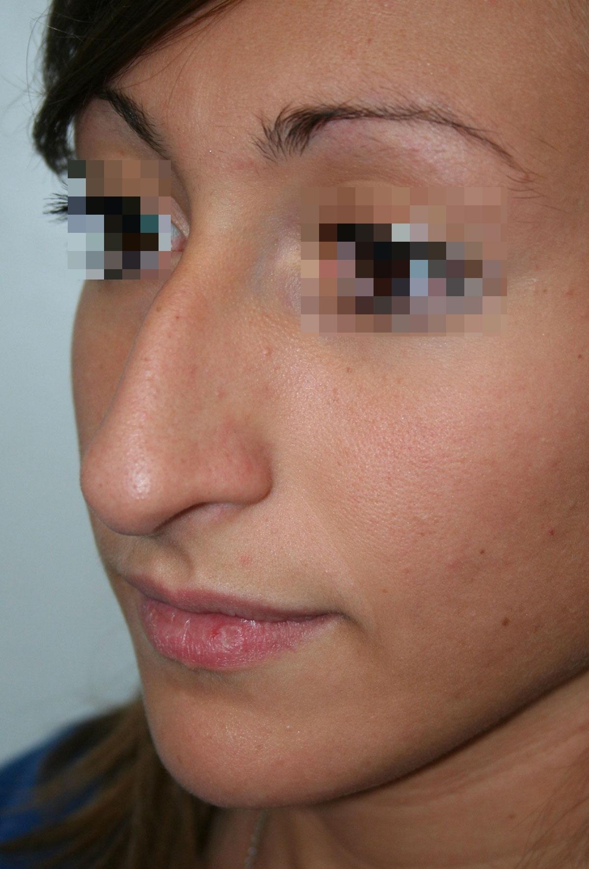 Before image